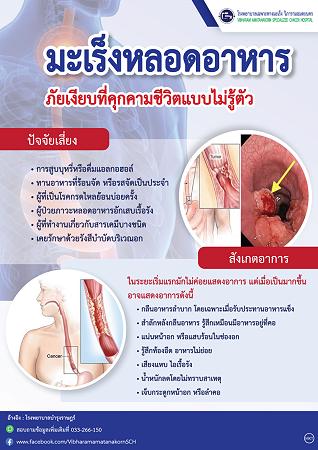 มะเร็งหลอดอาหาร ภัยเงียบที่คุกคามชีวิตแบบไม่รู้ตัว