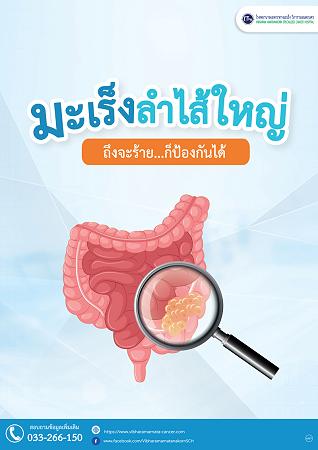 มะเร็งลำไส้ใหญ่