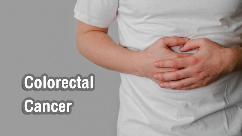 สาเหตุการเกิด? "มะเร็งลำไส้ใหญ่"